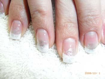 Bild026