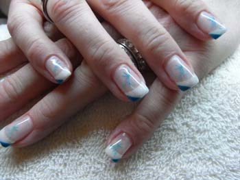 Bild035