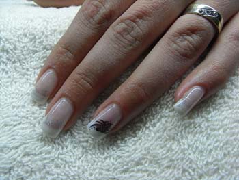 Bild036