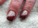 Bild011